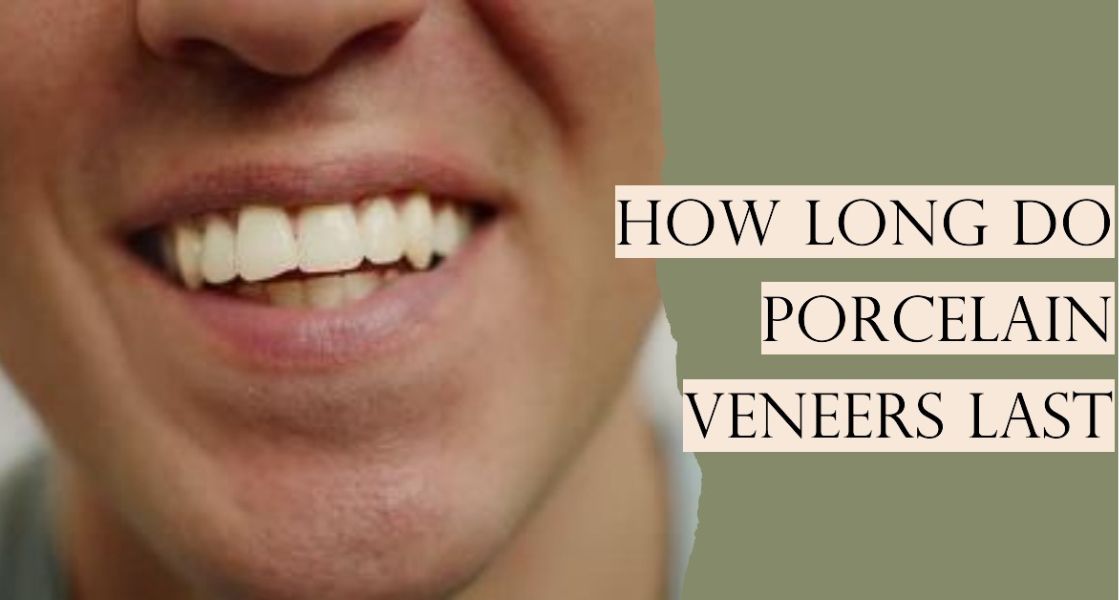 how long do porcelain veneers last