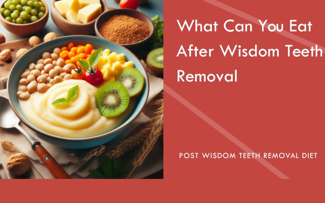 What Can You Eat After Wisdom Teeth Removal?