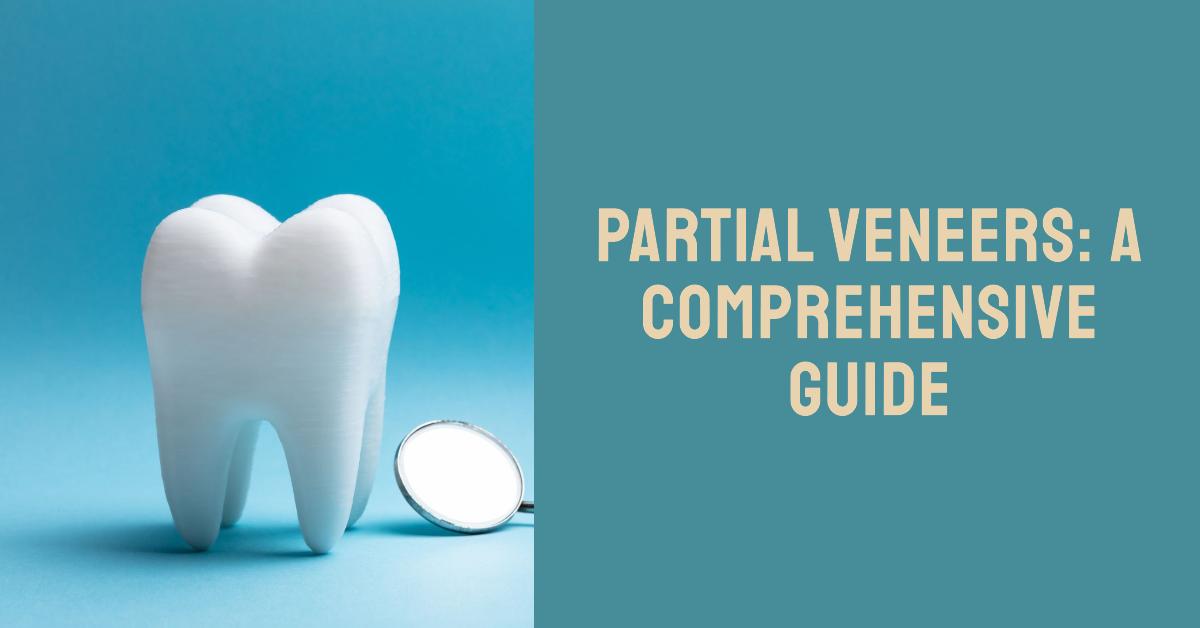 Partial Veneers A Comprehensive Guide