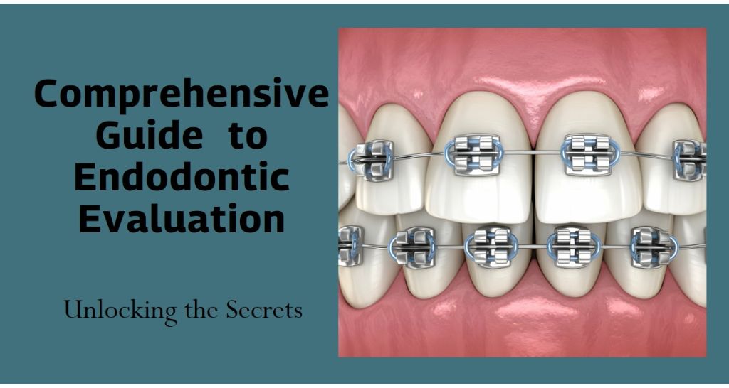 Unlocking the Secrets of Endodontic Evaluation Your Comprehensive Guide
