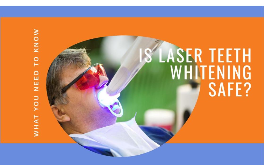is laser teeth whitening safe