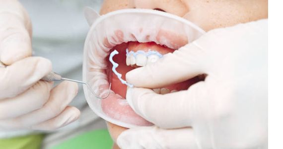 dentist preforming cosmetic surgery on patient