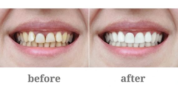 Innovative Cosmetic Dentistry Solutions