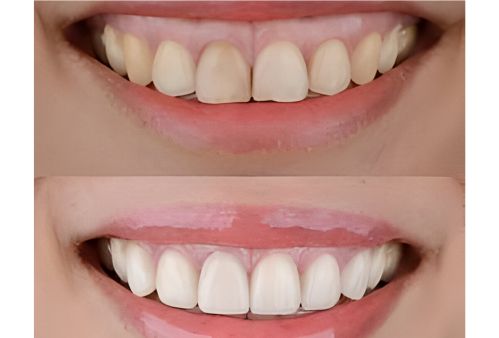 cosmetic dentist brisbane