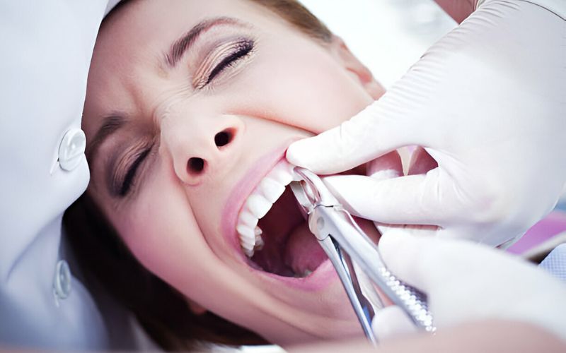 How to Reduce Pain After Tooth Removal