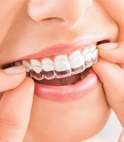 Can I Get Deep Teeth Cleaning While Having Invisalign?