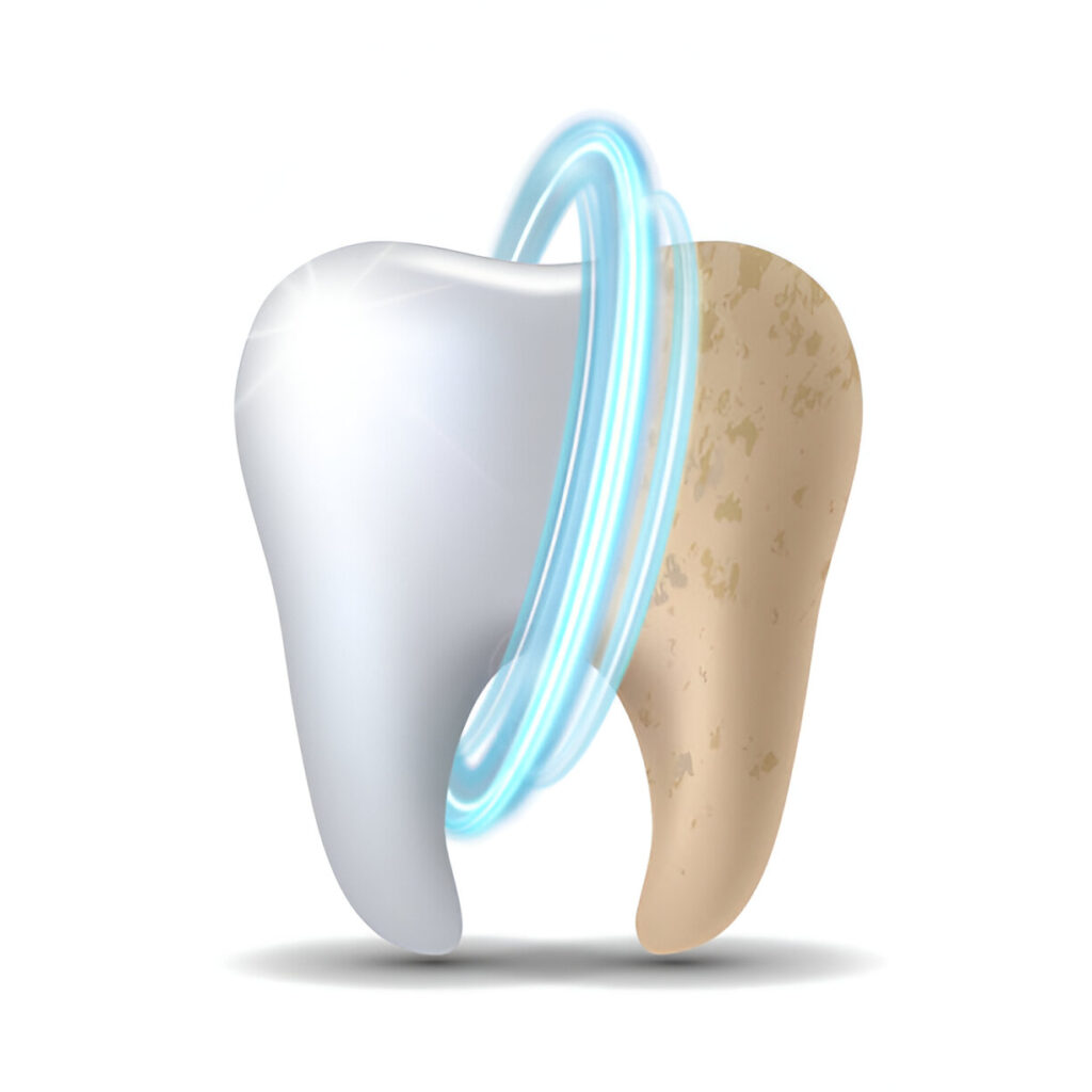 A Step-by-Step Guide to Your Teeth Whitening at Najmi Dental