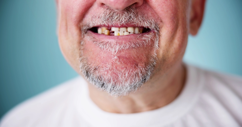 Age-Related-Dental-Changes-and-Solutions.