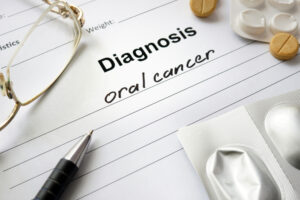 Treatment Options for Oral Cancer: What You Need to Know