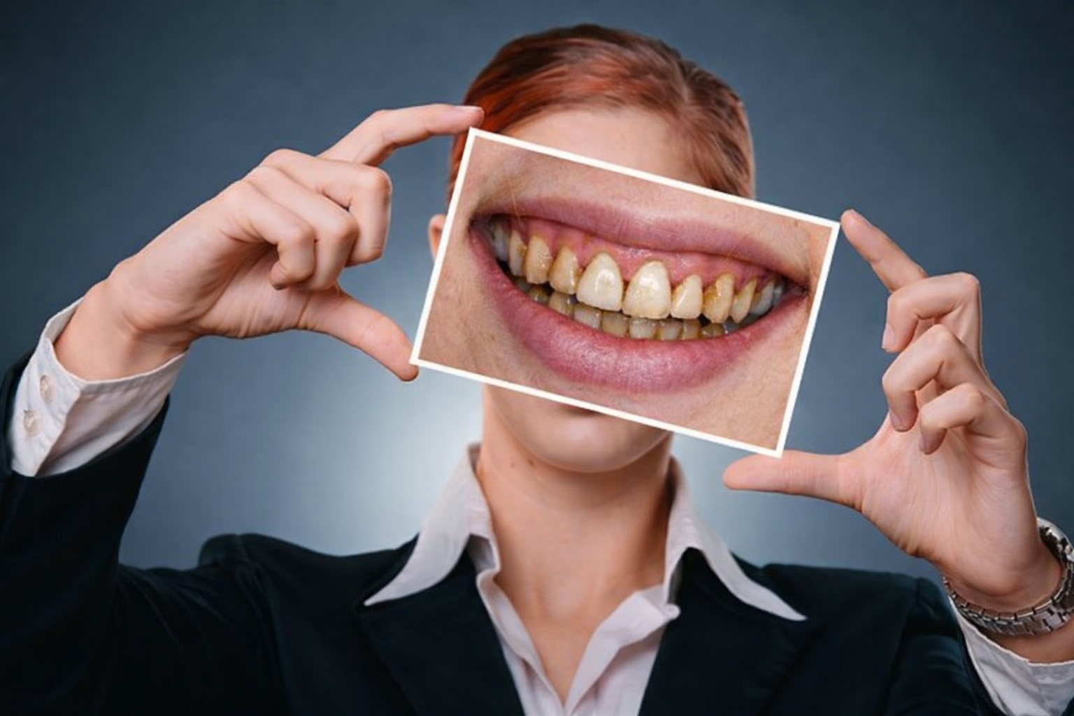 Woman in a black suit holds an image of her stained teeth, showcasing visible plaque and discoloration against a blue-gray background.