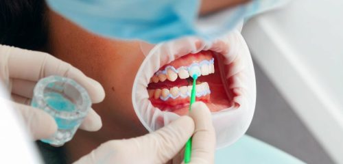What Dental Problems Can Cosmetic Dentistry Fix